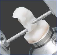 3D manufaturing of a tooth